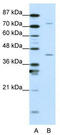 Transcription Elongation Factor A1 antibody, TA343635, Origene, Western Blot image 