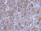 Transglutaminase 2 antibody, PA5-29356, Invitrogen Antibodies, Immunohistochemistry frozen image 