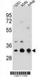 Tropomyosin 4 antibody, AP54345PU-N, Origene, Western Blot image 