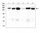 Desmoglein 2 antibody, A02035, Boster Biological Technology, Western Blot image 