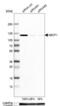 ATP Binding Cassette Subfamily F Member 1 antibody, NBP1-89314, Novus Biologicals, Western Blot image 