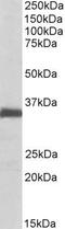 Ephrin B2 antibody, GTX88049, GeneTex, Western Blot image 