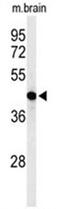 Glycerol-3-phosphate acyltransferase 4 antibody, AP50113PU-N, Origene, Western Blot image 