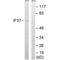 Eukaryotic Translation Initiation Factor 3 Subunit D antibody, A06212, Boster Biological Technology, Western Blot image 