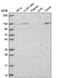 Unc-13 Homolog D antibody, NBP2-57827, Novus Biologicals, Western Blot image 