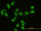 GIT ArfGAP 2 antibody, LS-B7870, Lifespan Biosciences, Immunofluorescence image 