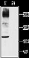Sodium Voltage-Gated Channel Alpha Subunit 10 antibody, GTX54805, GeneTex, Western Blot image 