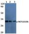 Eukaryotic Translation Initiation Factor 4 Gamma 1 antibody, A01351S1148-1, Boster Biological Technology, Western Blot image 
