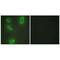 Branched Chain Keto Acid Dehydrogenase Kinase antibody, PA5-49761, Invitrogen Antibodies, Immunofluorescence image 