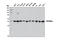 Protein Phosphatase 2 Regulatory Subunit Balpha antibody, 5689S, Cell Signaling Technology, Western Blot image 