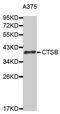 Cathepsin B antibody, MBS125144, MyBioSource, Western Blot image 