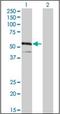 Interferon Regulatory Factor 4 antibody, orb89631, Biorbyt, Western Blot image 