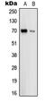 Tamm-Horsfall urinary glycoprotein antibody, GTX55176, GeneTex, Western Blot image 