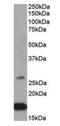 Ciliary Neurotrophic Factor antibody, orb125096, Biorbyt, Western Blot image 