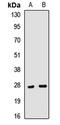 Clathrin Light Chain A antibody, orb412207, Biorbyt, Western Blot image 