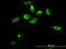 Thiopurine S-Methyltransferase antibody, LS-C133493, Lifespan Biosciences, Immunofluorescence image 