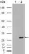 Carbonic anhydrase I antibody, GTX83196, GeneTex, Western Blot image 