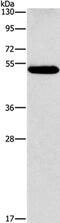 Calcitonin Receptor Like Receptor antibody, PA5-50644, Invitrogen Antibodies, Western Blot image 