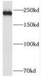 Phosphoinositide Kinase, FYVE-Type Zinc Finger Containing antibody, FNab06465, FineTest, Western Blot image 