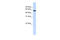 PDZ And LIM Domain 5 antibody, 25-451, ProSci, Enzyme Linked Immunosorbent Assay image 