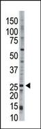 Ubiquitin Conjugating Enzyme E2 E3 antibody, PA5-12066, Invitrogen Antibodies, Western Blot image 