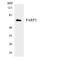 PARP2 antibody, LS-C200465, Lifespan Biosciences, Western Blot image 