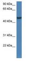 Armadillo Repeat Containing X-Linked 1 antibody, NBP1-79204, Novus Biologicals, Western Blot image 