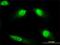 Diaphanous Related Formin 3 antibody, H00081624-M01, Novus Biologicals, Immunofluorescence image 