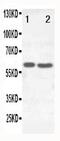 Solute Carrier Family 22 Member 6 antibody, PA5-80017, Invitrogen Antibodies, Western Blot image 