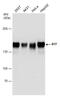 BCL2 Associated Transcription Factor 1 antibody, GTX130490, GeneTex, Western Blot image 