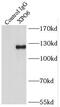 Exportin 6 antibody, FNab09550, FineTest, Immunoprecipitation image 