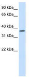 SAP30 Binding Protein antibody, TA343707, Origene, Western Blot image 