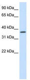 SAP30 Binding Protein antibody, TA343707, Origene, Western Blot image 