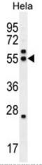 Tubulin Beta 8 Pseudogene 12 antibody, AP54163PU-N, Origene, Western Blot image 