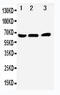 Nuclear Receptor Subfamily 4 Group A Member 1 antibody, LS-C312829, Lifespan Biosciences, Western Blot image 