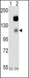 Tyrosine-protein kinase-like 7 antibody, PA5-14909, Invitrogen Antibodies, Western Blot image 