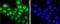 Protein Kinase C Alpha antibody, NBP2-66799, Novus Biologicals, Immunocytochemistry image 