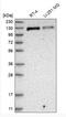 RecQ Like Helicase 4 antibody, NBP2-47310, Novus Biologicals, Western Blot image 