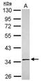 Solute Carrier Family 25 Member 36 antibody, PA5-31606, Invitrogen Antibodies, Western Blot image 