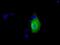Ketohexokinase antibody, NBP2-02639, Novus Biologicals, Immunocytochemistry image 