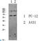 Forkhead Box O3 antibody, LS-C813413, Lifespan Biosciences, Western Blot image 