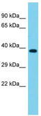 Serologically defined colon cancer antigen 3 antibody, TA332028, Origene, Western Blot image 