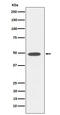 Transcription Factor Dp-1 antibody, M04204, Boster Biological Technology, Western Blot image 