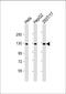 Leucine Rich Repeats And Immunoglobulin Like Domains 3 antibody, 61-250, ProSci, Western Blot image 