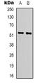 Lipase I antibody, LS-C368903, Lifespan Biosciences, Western Blot image 