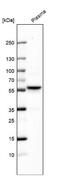 LFNG O-Fucosylpeptide 3-Beta-N-Acetylglucosaminyltransferase antibody, NBP2-39097, Novus Biologicals, Western Blot image 