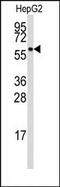 Aldehyde Dehydrogenase 4 Family Member A1 antibody, AP14724PU-N, Origene, Western Blot image 