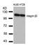 Integrin Subunit Beta 3 antibody, GTX50435, GeneTex, Western Blot image 