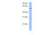 ETS2 Repressor Factor antibody, 27-384, ProSci, Western Blot image 