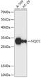 NAD(P)H Quinone Dehydrogenase 1 antibody, GTX32756, GeneTex, Western Blot image 